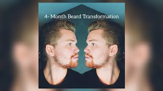 Quick 1 Year BEARD Growth Time Lapse [upl. by Mairim156]