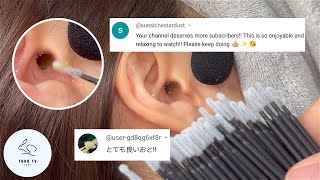 ASMR  ミクロスワブで最高の耳かき体験  Best Ear Cleaning Experience With Micro Swabs [upl. by Mihcaoj]