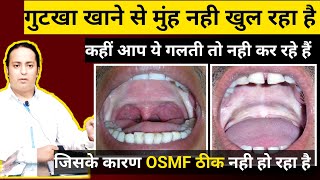 OSMF में ये गलती भुलकर भी नही करनी चाहिए ।। Submucous Fibrosis ।। Redused Mouth Opening osmf [upl. by Boothman999]