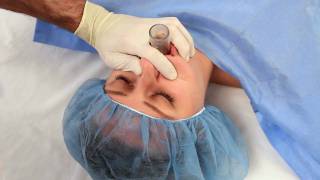 NuMask in Anesthesiology IntraOral Mask IOM®  Oropharyngeal Airway OPA Training Video [upl. by Htebzil442]