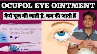 ocupol eye ointment how to apply  ocupol eye ointment  ocupol eye ointment uses in hindi [upl. by Bywaters106]