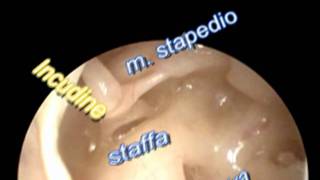 Anatomia dellorecchio medio [upl. by Charleton850]