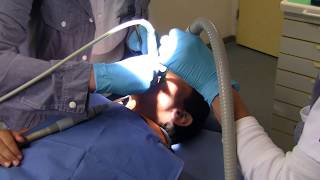 Tooth filling in school dental clinic Part 13 Tooth filling [upl. by Aurelie254]