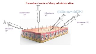 Parenteral routePart 2Routes of Drug administration pharmacology pharmacy [upl. by Henleigh866]