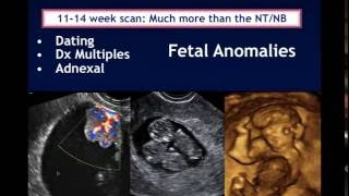 AIUM Webinar Systematic Evaluation of the 1114 Week Fetus Touching on ISUOG Guidelines [upl. by Tnarud]