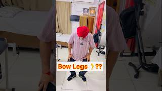 Best Exercises for Bow Legs Or Bow Knees At Home shorts [upl. by Donadee450]