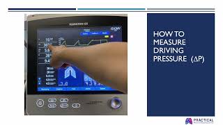 Measuring Respiratory System Elastance during Controlled Mechanical Ventilation Why and How [upl. by Sera708]