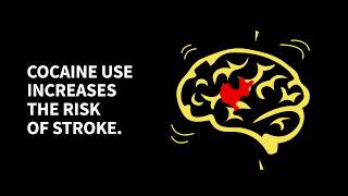 Cocaine use increases the risk of stroke [upl. by Obnukotalo]