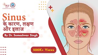 Sinus के कारण लक्षण और इलाज  Sinusitis Treatment  By Dr Someshwar Singh [upl. by Borgeson]