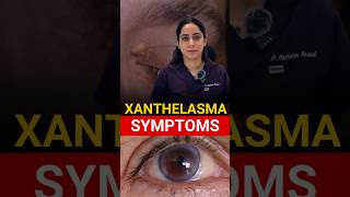 Most Common Symptoms Xanthelasma [upl. by Faria]