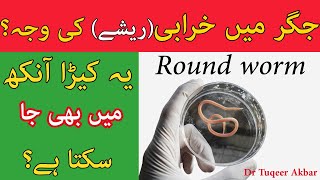 Round worm  Liver Abscess Ascariasis  symptoms Cough Treatment Urdu amp Hindi By Dr Tuqeer Akbar [upl. by Bobker921]