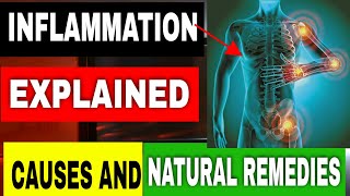 Inflammation Explained Causes amp Natural Remedies [upl. by Odnavres]