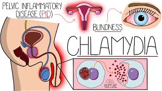 Understanding Chlamydia Chlamydia Trachomatis Explained Clearly [upl. by Verdi]