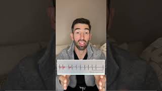 Atrial fibrillation ECG review and tips for students and new nurses [upl. by Lindsy]