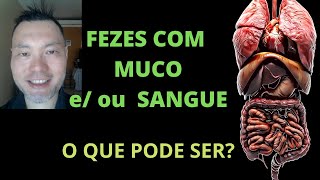 FEZES COM MUCO E OU SANGUE O QUE PODE SER [upl. by Weatherby861]