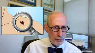 How is melanoma diagnosed [upl. by Adnirak]