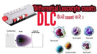 DLC TEST Differential Leukocyte countहिंदी dlc dlctest [upl. by Ttik]