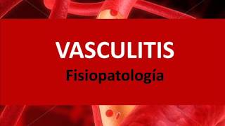 Vasculitis  Fisiopatología [upl. by Islean]