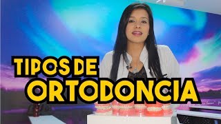 Tipos de BracketsOrtodoncia – Odontología Láser [upl. by Klepac]