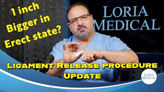 Ligament Release procedure Update 2024 [upl. by Habas]