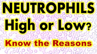 Neutrophils count High or Low Know the Reasons [upl. by Kcinnay979]