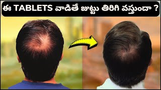 AskDrJohnWatts  ఈ TABLETS వాడితే జుట్టు తిరిగి వస్తుందా   Hair Specialist Explains [upl. by Aiyt]