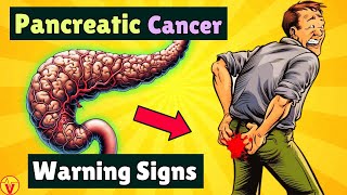 10 Warning Signs of PANCREATIC CANCER That Will SHOCK You  VisitJoy [upl. by Oralle]