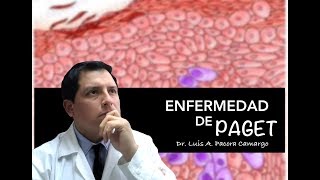 ENFERMEDAD DE PAGET ❗El CÁNCER ⚠️ de PEZÓN 😱 [upl. by Bettencourt898]