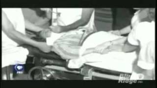 Lobotomy  PBS documentary on Walter Freemanmp4 [upl. by Maurey]