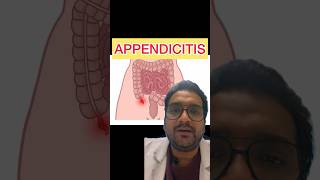 Acute Appendicitis Symptoms and treatment appendicitis appendix [upl. by Xuaegram124]