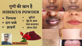 HIBISCUS POWDER BENEFITS I HIBISCUSS FLOWER FOR SKIN CARE AND HAIR CARE I DR MANOJ DAS [upl. by Acima275]