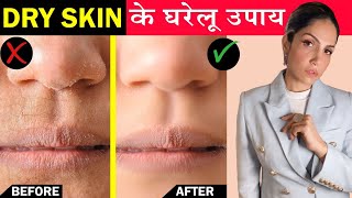 Dry Skin Care in Winter  Home Remedies to Moisturize Skin Naturally  रूखी त्वचा के घरेलू उपाय [upl. by Deutsch]