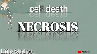 Necrosis and types of necrosis pathology robbins [upl. by Coraline925]