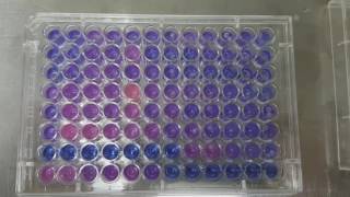 Resazirun Test for Metabolic Activity of Bacteria [upl. by Nnaylime]