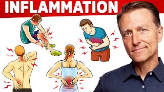 The 1 Best Remedy for Inflammation Autoimmune Gut and Arthritis That You Never Considered [upl. by Cutty]