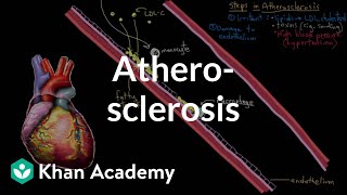 Atherosclerosis  Circulatory System and Disease  NCLEXRN  Khan Academy [upl. by Beane146]