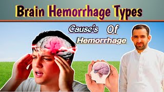 Animated Brain HemorrhageIntra cranial Bleeding Causes [upl. by Llennej824]