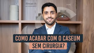 Como acabar de vez com o caseum amigdaliano [upl. by Aivataj]