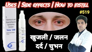 Tobramycin dexamethasone eye drops  Toba dm eye drops uses in hindi  Tobradex eye drops use [upl. by Ahsil]