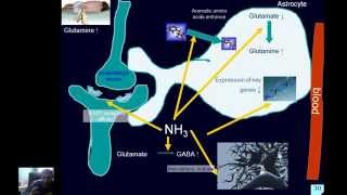 Pathophysiology of liver  part2 [upl. by Samuele]