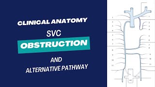 SVC Obstruction amp Alternative Pathways Explained in Bangla  MBBS 1st year Tutorial [upl. by Matheson450]