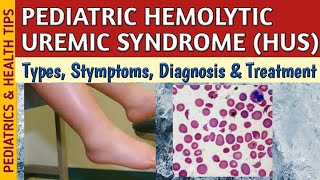 Hemolytic Uremic Syndrome HUS Symptoms Diagnosis amp Treatment In Children [upl. by Allesiram]