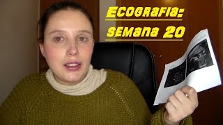 ECOGRAFIA 20 SEMANAS  CONFIRMAN ES NIÑA [upl. by Swarts]