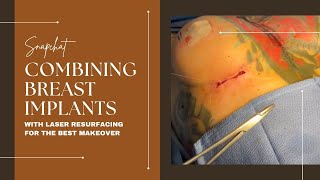 SNAPCHAT  COMBINING BREAST IMPLANTS WITH LASER RESURFACING FOR THE BEST MAKEOVER  Dr Emer amp Rojas [upl. by Sparks]