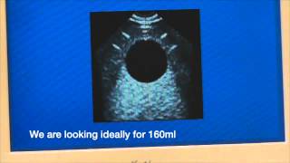 Bladder Scanner Calibration Tutorial from WinHealthcom [upl. by Nara]