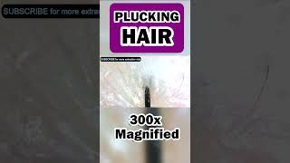 Plucking Hair at 300x Magnified  See the root keratin skin cells and follicle [upl. by Careaga]