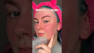 ROSACEA vs BLUSH ✨🫶🏼🩷 blush makeup redness rosacea [upl. by Fezoj]