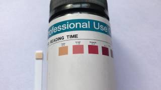 How To Read Ketone Test Strips and What Are Normal Ketone Levels [upl. by Htaek]