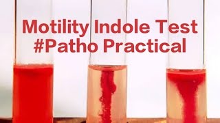 Motility Indole Patho Bacterial Motility Indole test [upl. by Ainegue39]