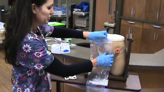 Southern Nursing Skills  Ostomy [upl. by Aryam]